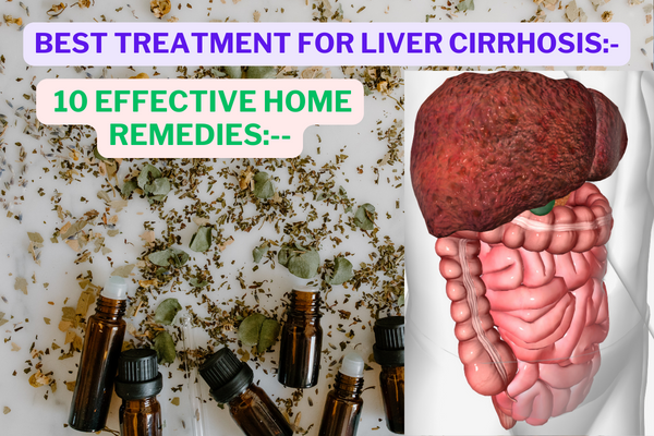 Treatment for Liver Cirrhosis: 10 Home Remedies